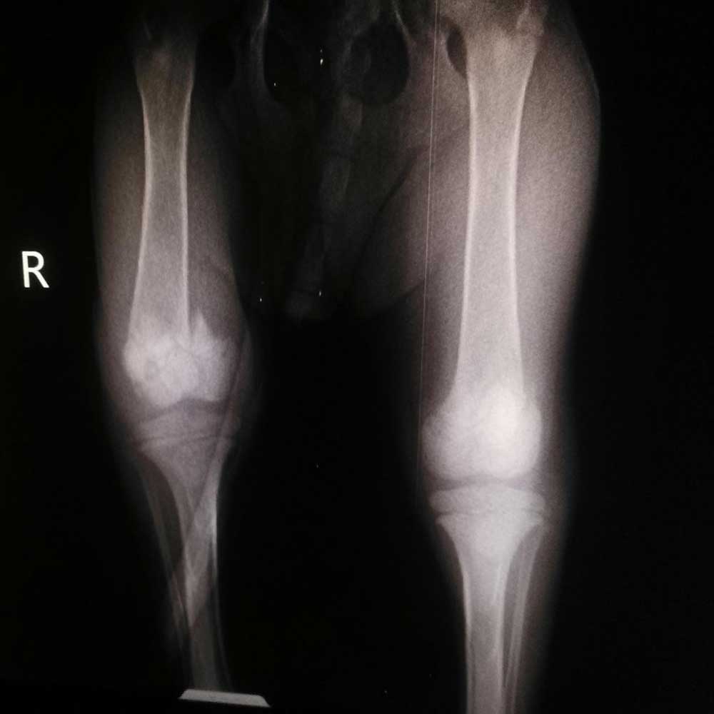 GOLDIE: THE PUPPY HIT BY A CAR