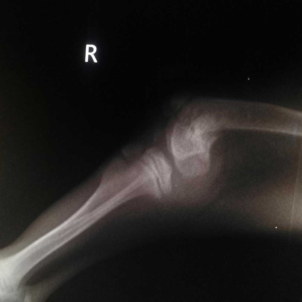 GOLDIE: THE PUPPY HIT BY A CAR