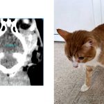 BERT CT SCAN RESULTS